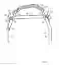 Fig. 07 - WHEEL TRACTION ENHANCEMENT DEVICE