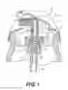 Fig. 02 - Insert for dispensing a compressed gas product, system with such an insert, and method of dispensing a compressed gas product