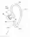 Fig. 01 - AURICLE-INSTALLED APPARATUS