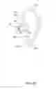 Fig. 11 - AURICLE-INSTALLED APPARATUS