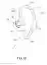 Fig. 13 - AURICLE-INSTALLED APPARATUS