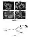 Fig. 06 - Method of enriching stem and/or progenitor cells