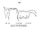 Fig. 08 - POLYMERIZATION OF ALKYL(BETA-N-ALKYLAMINOPROPIONATES) FORMING UNIQUE POLYAMIDE COMPOSITIONS