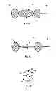 Fig. 06 - Resector balloon system