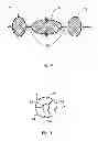 Fig. 07 - Resector balloon system