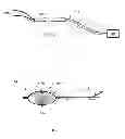 Fig. 08 - Resector balloon system