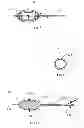 Fig. 09 - Resector balloon system