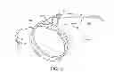 Fig. 03 - ENDOSCOPE WITH AN IMAGING CATHETER ASSEMBLY AND METHOD OF CONFIGURING AN ENDOSCOPE