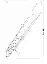 Fig. 43 - ROTATE-TO-ADVANCE CATHETERIZATION SYSTEM