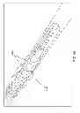 Fig. 49 - ROTATE-TO-ADVANCE CATHETERIZATION SYSTEM