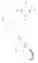 Fig. 35 - SYSTEM AND METHOD FOR SENSING SHAPE OF ELONGATED INSTRUMENT
