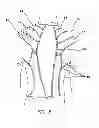 Fig. 06 - Sensory motor stimulation garments and methods