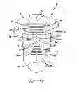 Fig. 10 - Sensory motor stimulation garments and methods