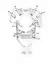 Fig. 11 - Sensory motor stimulation garments and methods