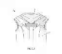 Fig. 18 - Sensory motor stimulation garments and methods