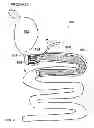 Fig. 01 - Methods and apparatus for anchoring within the gastrointestinal tract