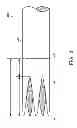 Fig. 05 - Methods and apparatus for anchoring within the gastrointestinal tract