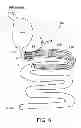 Fig. 07 - Methods and apparatus for anchoring within the gastrointestinal tract