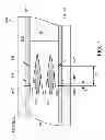 Fig. 08 - Methods and apparatus for anchoring within the gastrointestinal tract