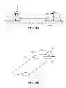 Fig. 09 - Methods and apparatus for anchoring within the gastrointestinal tract