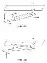 Fig. 10 - Methods and apparatus for anchoring within the gastrointestinal tract