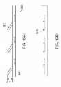 Fig. 13 - Methods and apparatus for anchoring within the gastrointestinal tract