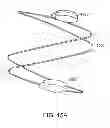 Fig. 16 - Methods and apparatus for anchoring within the gastrointestinal tract