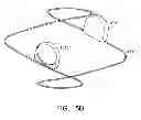 Fig. 17 - Methods and apparatus for anchoring within the gastrointestinal tract