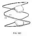 Fig. 19 - Methods and apparatus for anchoring within the gastrointestinal tract