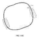 Fig. 20 - Methods and apparatus for anchoring within the gastrointestinal tract
