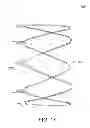 Fig. 22 - Methods and apparatus for anchoring within the gastrointestinal tract