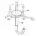 Fig. 01 - Systems and methods related to gastro-esophageal implants