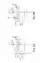 Fig. 09 - SYSTEMS AND METHODS FOR TREATING A SPINE THROUGH A SINGLE VERTEBRAL BODY INSERTION POINT