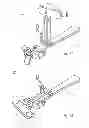 Fig. 08 - Orthopedic guide and method