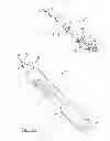 Fig. 02 - Device for repairing a meniscal tear
