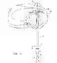 Fig. 11 - Device for repairing a meniscal tear
