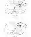 Fig. 12 - Device for repairing a meniscal tear