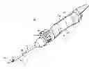 Fig. 01 - Method of endoscopically removing tissue