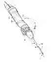 Fig. 02 - Method of endoscopically removing tissue