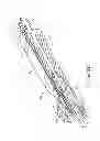 Fig. 05 - Method of endoscopically removing tissue