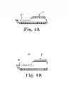 Fig. 07 - Method of endoscopically removing tissue