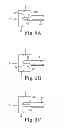 Fig. 08 - Method of endoscopically removing tissue