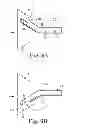 Fig. 09 - Method of endoscopically removing tissue