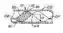 Fig. 01 - ENDOLUMINAL FILTER WITH FIXATION