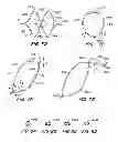 Fig. 07 - ENDOLUMINAL FILTER WITH FIXATION