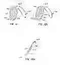 Fig. 09 - ENDOLUMINAL FILTER WITH FIXATION