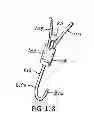 Fig. 63 - ENDOLUMINAL FILTER WITH FIXATION