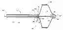 Fig. 01 - IMPLANT RETRIEVAL SYSTEM