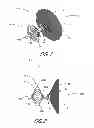 Fig. 02 - IMPLANT RETRIEVAL SYSTEM