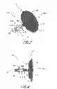 Fig. 03 - IMPLANT RETRIEVAL SYSTEM